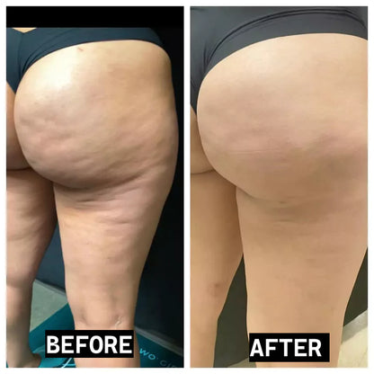 Lumia Selülit Görünümünü Azaltmaya Yardımcı Krem