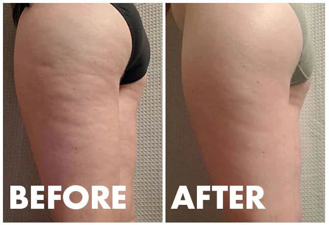 Lumia Selülit Görünümünü Azaltmaya Yardımcı Krem